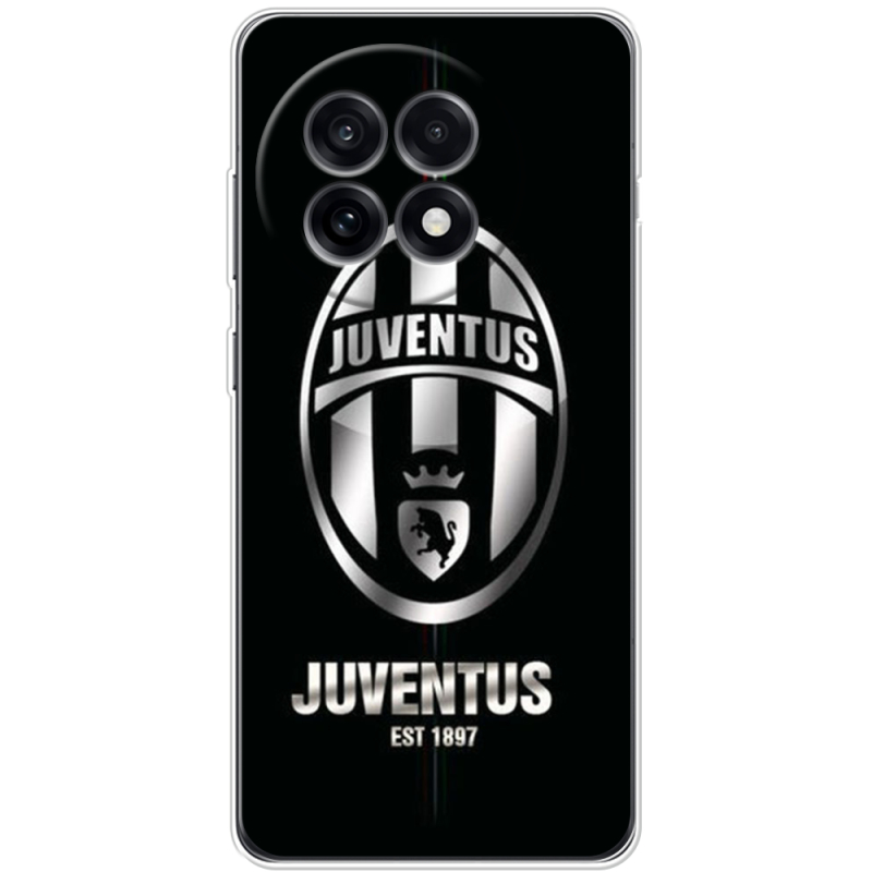 Чохол BoxFace OnePlus Ace 5 