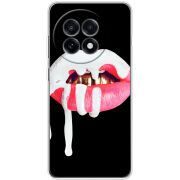 Чохол BoxFace OnePlus Ace 5 