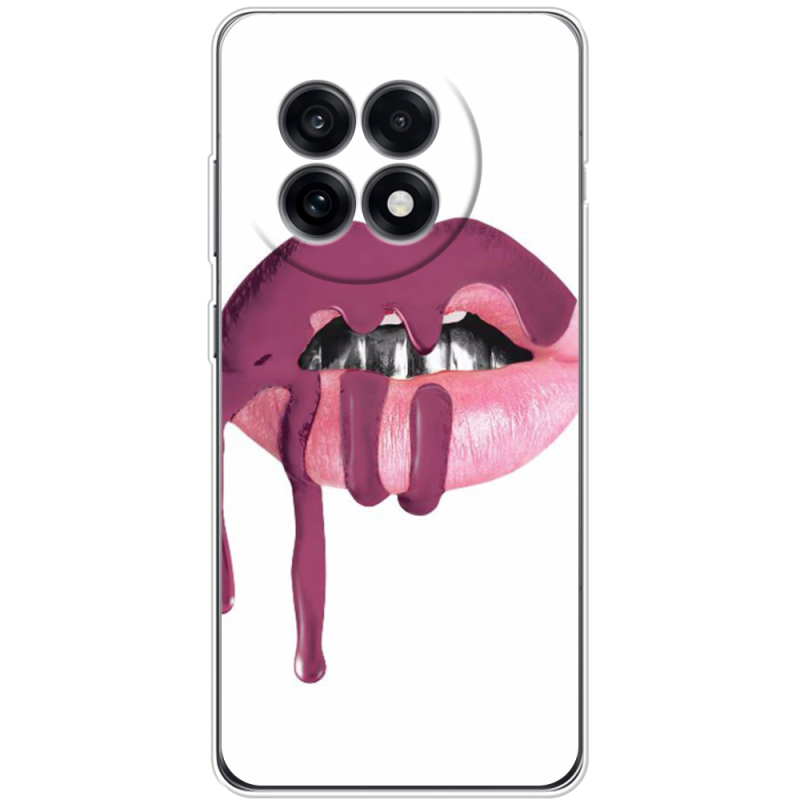 Чохол BoxFace OnePlus Ace 5 