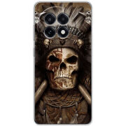 Чохол BoxFace OnePlus Ace 5 