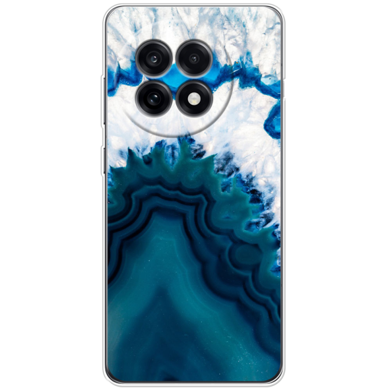 Чохол BoxFace OnePlus Ace 5 