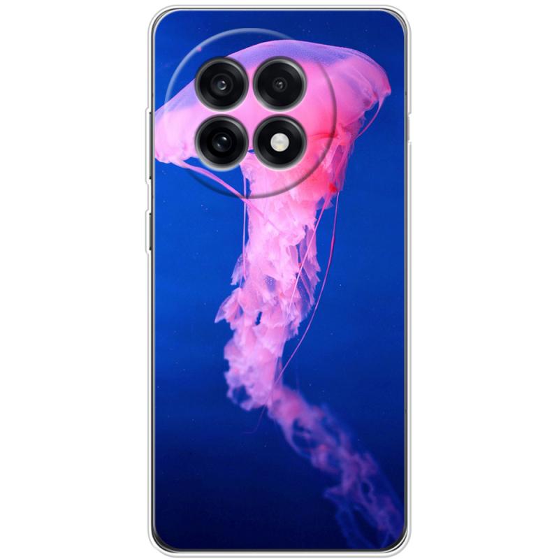 Чохол BoxFace OnePlus Ace 5 