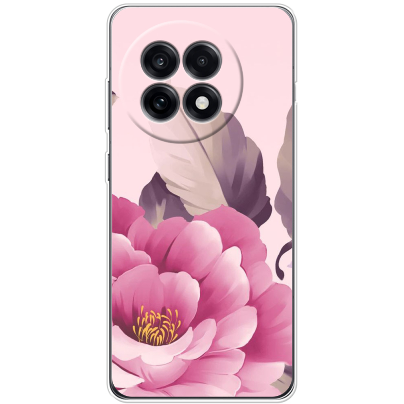 Чохол BoxFace OnePlus Ace 5 