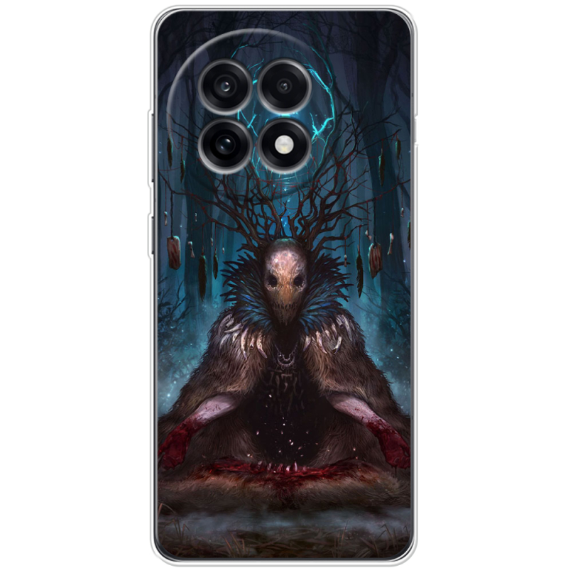 Чохол BoxFace OnePlus Ace 5 