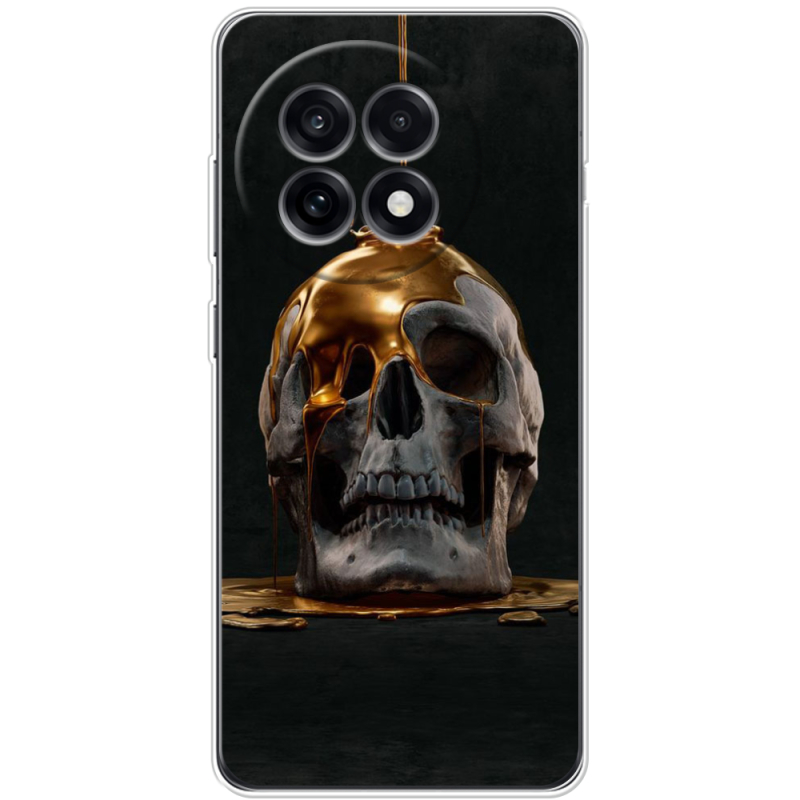 Чохол BoxFace OnePlus Ace 5 