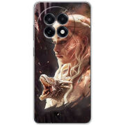 Чохол BoxFace OnePlus Ace 5 