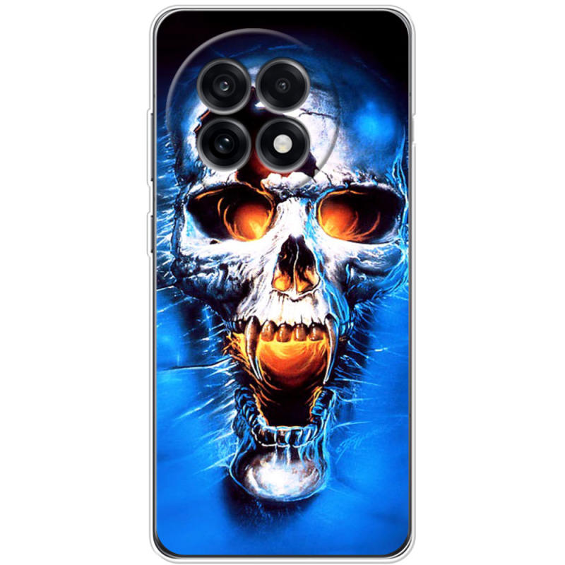 Чохол BoxFace OnePlus Ace 5 