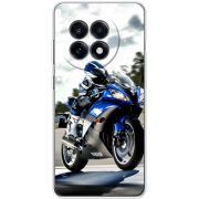 Чохол BoxFace OnePlus Ace 5 