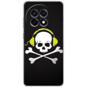 Чохол BoxFace OnePlus Ace 5 