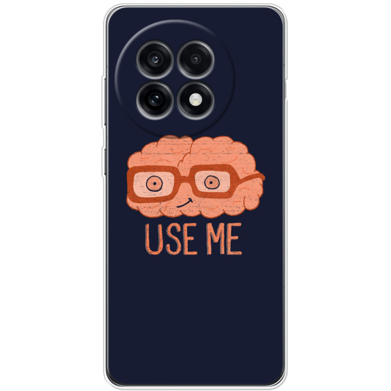 Чохол BoxFace OnePlus Ace 5 