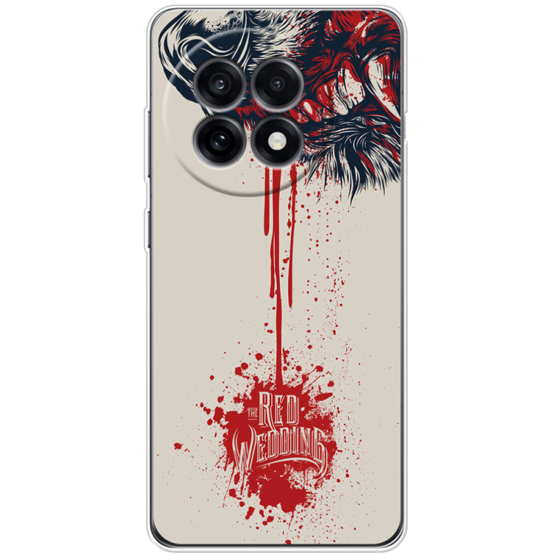 Чохол BoxFace OnePlus Ace 5 