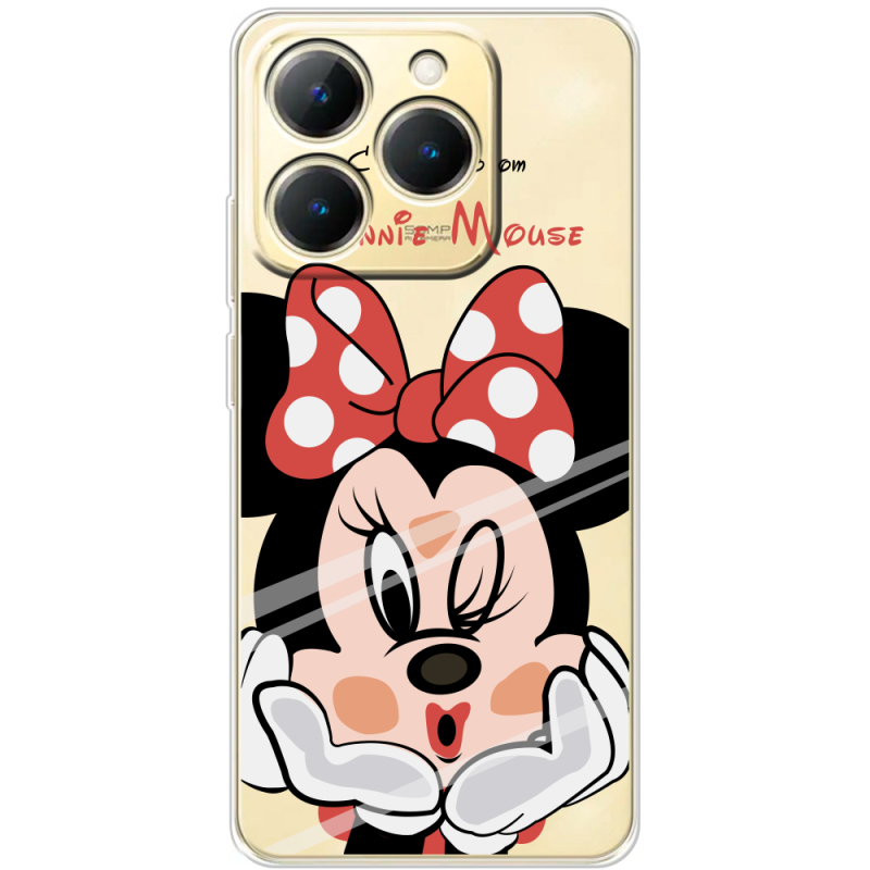 Прозорий чохол BoxFace Realme 15T Lady M