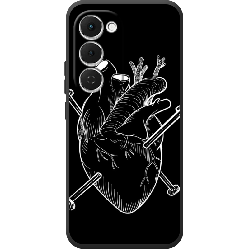 Чохол BoxFace Tecno Spark 40 Pro Plus 