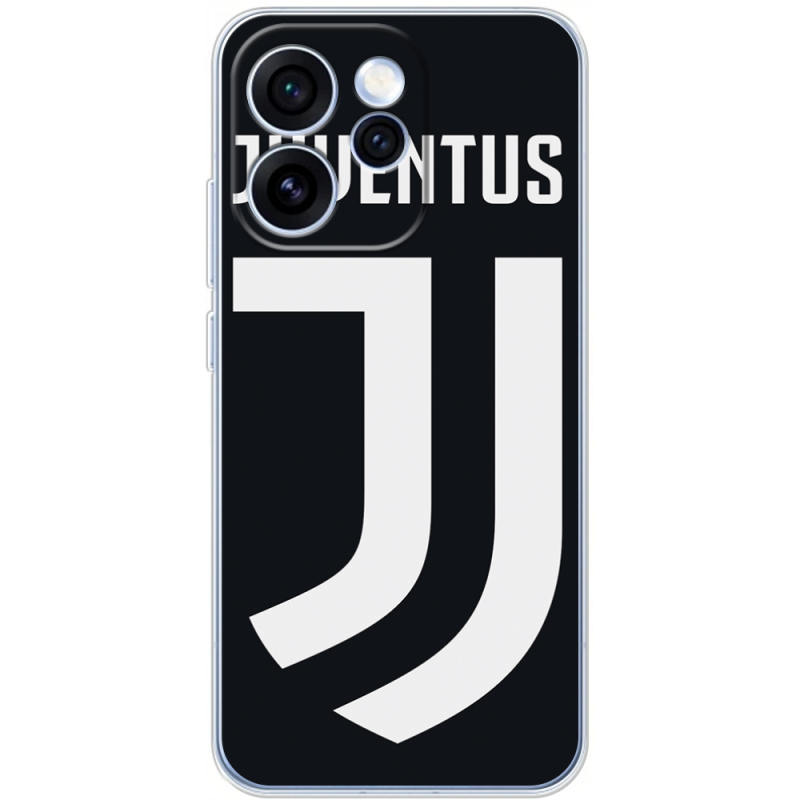 Чохол BoxFace OPPO Reno 15 Pro FC J