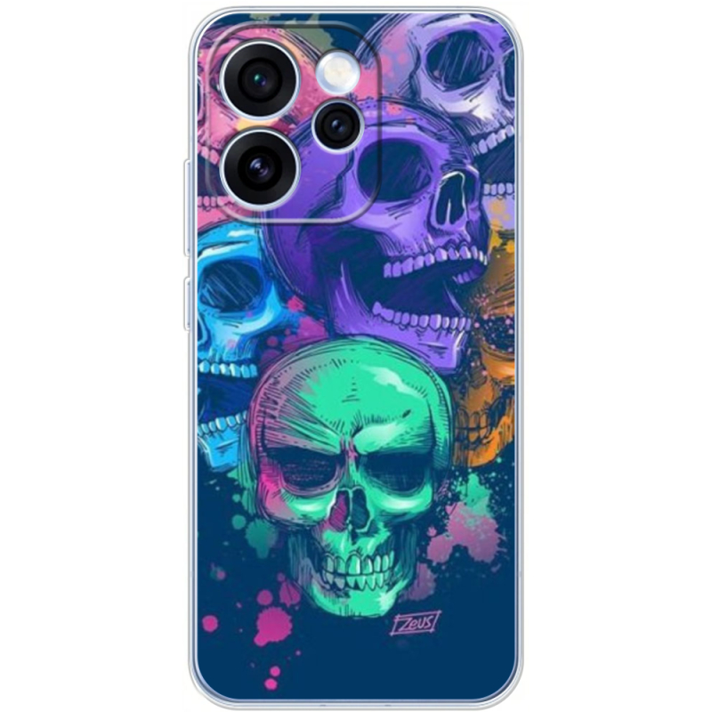 Чохол BoxFace OPPO Reno 15 Pro 