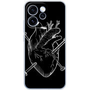 Чохол BoxFace OPPO Reno 15 Pro 