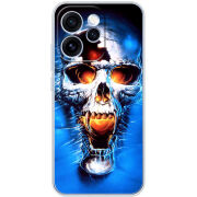 Чохол BoxFace OPPO Reno 15 Pro 