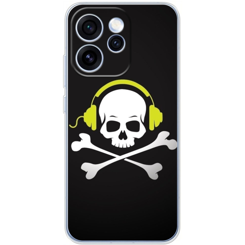 Чохол BoxFace OPPO Reno 15 Pro 