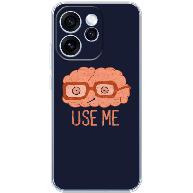 Чохол BoxFace OPPO Reno 15 Pro 