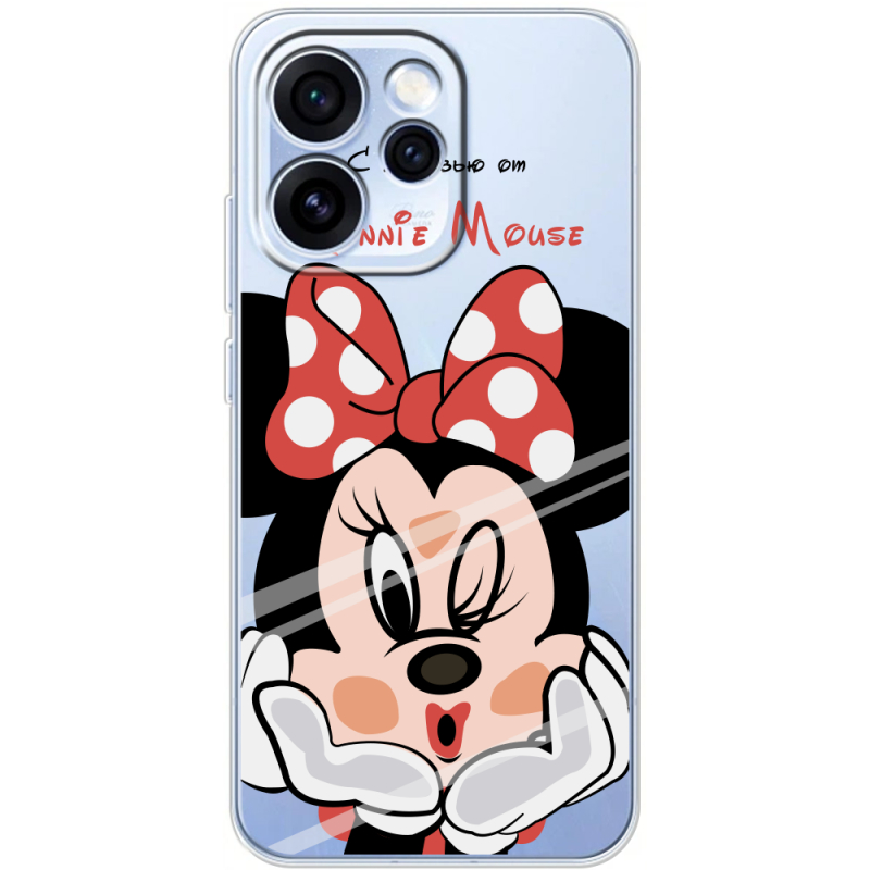 Прозорий чохол BoxFace OPPO Reno 15 Pro Lady M