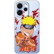 Прозорий чохол BoxFace OPPO Reno 15 Pro Naruto