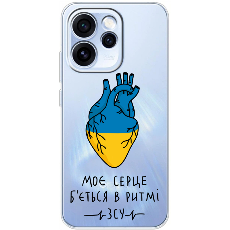 Прозорий чохол BoxFace OPPO Reno 15 Pro Моє серце в ритмі ЗСУ