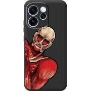 Чорний чохол BoxFace OPPO Reno 15 Pro Титан