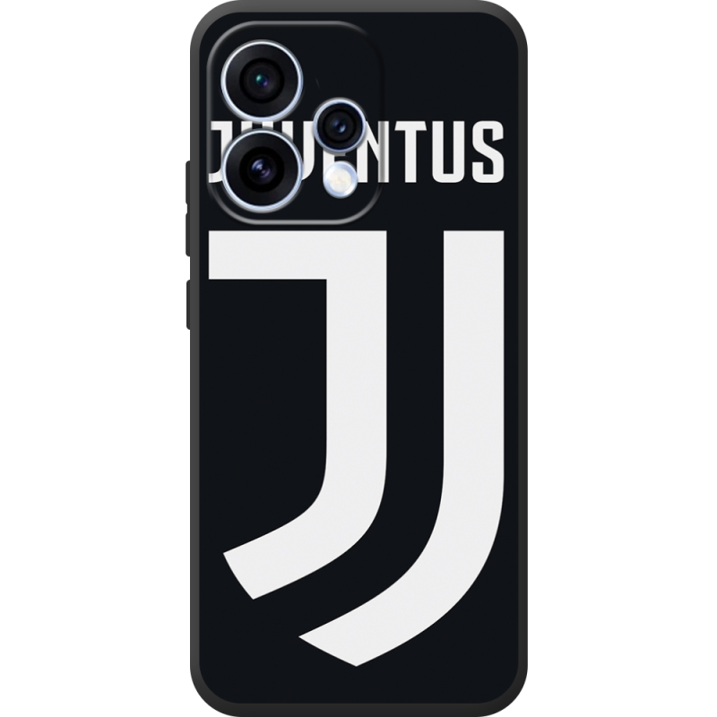 Чохол BoxFace OPPO Reno 15 FC J