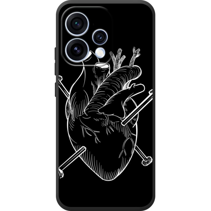 Чохол BoxFace OPPO Reno 15 