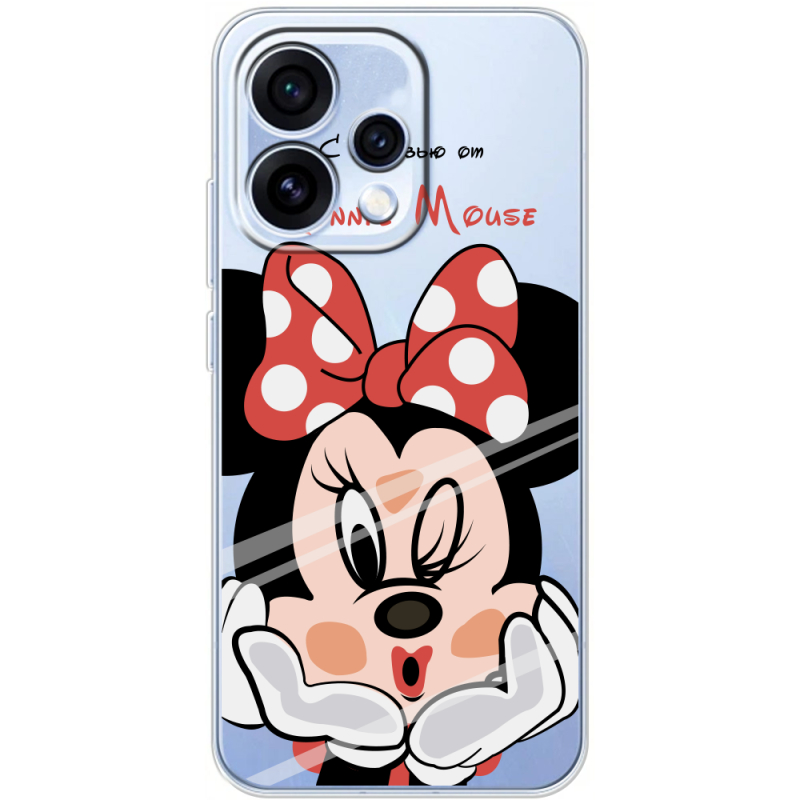 Прозорий чохол BoxFace OPPO Reno 15 Lady M