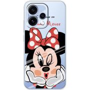 Прозорий чохол BoxFace OPPO Reno 15 Lady M