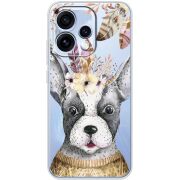 Прозорий чохол BoxFace OPPO Reno 15 