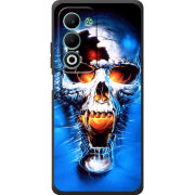 Чохол BoxFace OPPO A5 