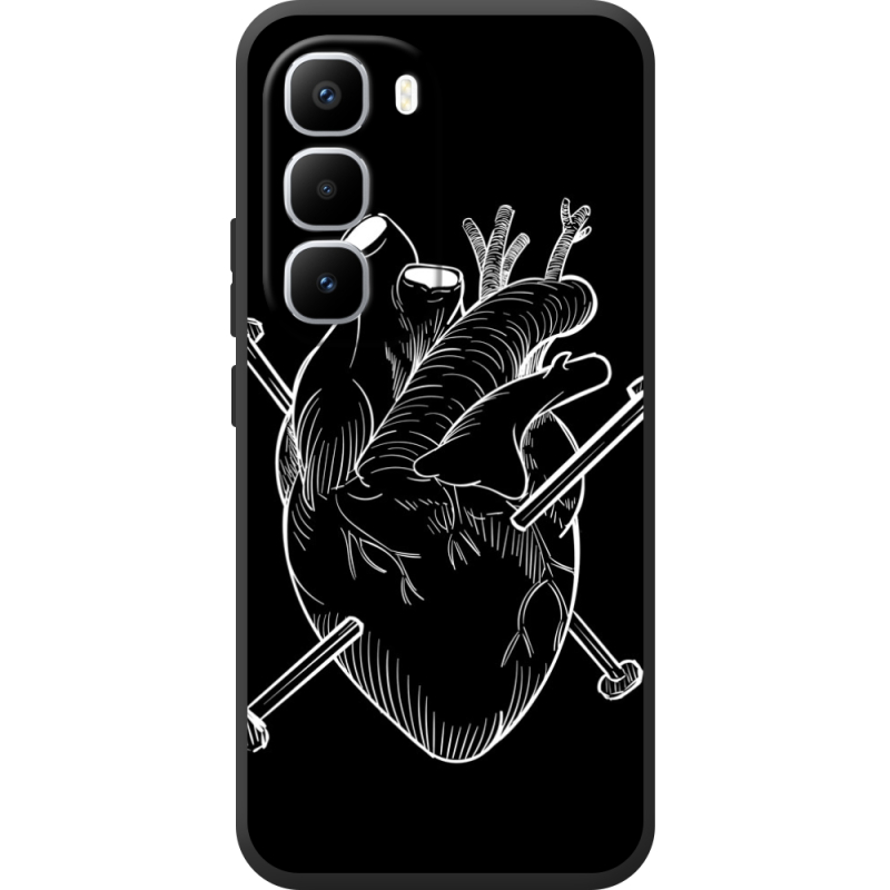 Чохол BoxFace Infinix Hot 60 Pro Plus 