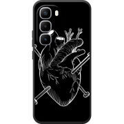 Чохол BoxFace Infinix Hot 60 Pro Plus 