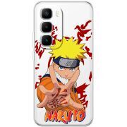 Прозорий чохол BoxFace Infinix Hot 60 Pro Plus Naruto