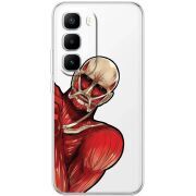 Прозорий чохол BoxFace Infinix Hot 60 Pro Plus Титан