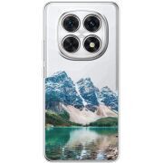 Прозорий чохол BoxFace Poco M8 Blue Mountain