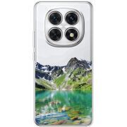 Прозорий чохол BoxFace Poco M8 Green Mountain