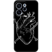 Чохол BoxFace OPPO Reno 15 F 