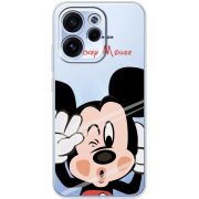 Прозорий чохол BoxFace OPPO Reno 15 F Mister M