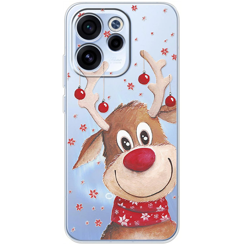 Прозорий чохол BoxFace OPPO Reno 15 F Winter Deer