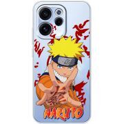 Прозорий чохол BoxFace OPPO Reno 15 F Naruto