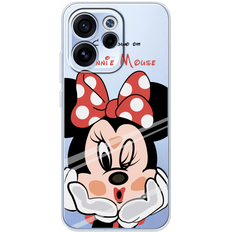 Прозорий чохол BoxFace OPPO Reno 15 FS Lady M