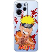 Прозорий чохол BoxFace OPPO Reno 15 FS Naruto
