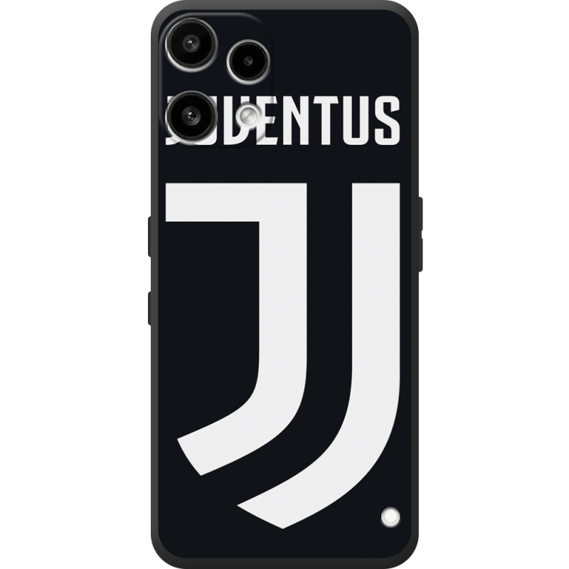 Чохол BoxFace Nothing Phone (3a) Lite FC J