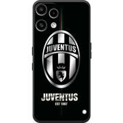 Чохол BoxFace Nothing Phone (3a) Lite 