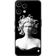 Чохол BoxFace Nothing Phone (3a) Lite 