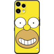 Чохол BoxFace Nothing Phone (3a) Lite 