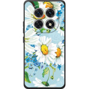 Чохол BoxFace Xiaomi Redmi Note 15 4G 